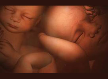 Unborn twins