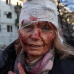 Wounded Ukrainian woman
