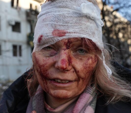 Wounded Ukrainian woman